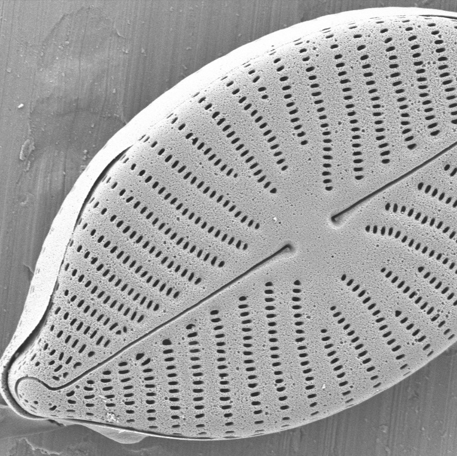 diatom